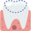 امکان ساخت روکشهای تمام سرامیکی به روشهای CAD.CAM - I.P.S - Zirconia - Alumina